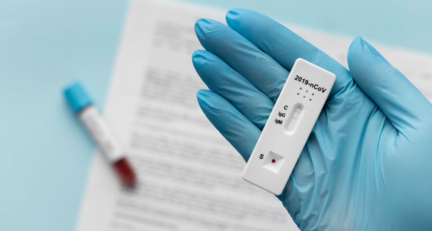 Service - Antibody Tests Image